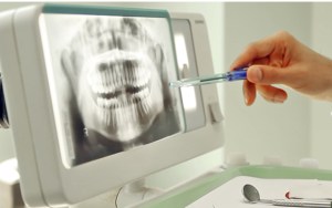 Desarrollan un protector bucal inteligente capaz de controlar el bruxismo Desarrollan un protector bucal inteligente capaz de controlar el bruxismo
