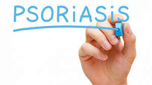 Psoriasis: estigma y discriminación en 8 de cada 10 pacientes Psoriasis: estigma y discriminación en 8 de cada 10 pacientes