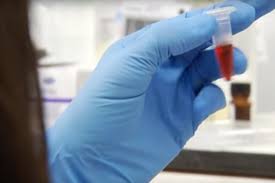 Biopsia líquida: método no invasivo, rápido y sencillo ¿cuándo estará&nbsp;disponible?