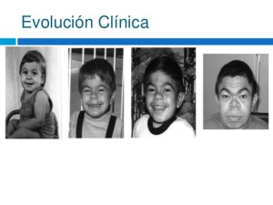 Cómo hacer un diagnóstico temprano de las mucoliposacaridosis #DíaMundialdelaMPS Cómo hacer un diagnóstico temprano de las mucoliposacaridosis #DíaMundialdelaMPS