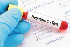Hepatitis C paradigma de las enfermedades subdiagnosticadas