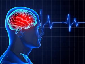 Alerta por una disminución en la internación de pacientes con Accidente Cerebrovascular&nbsp;(ACV)
