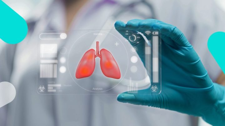 Se realizó el primer consenso nacional con recomendacionespara la detección temprana en Cáncer de Pulmón