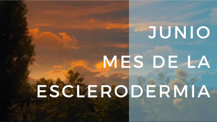Jornada Internacional de Esclerodermia, qué es y cómo se trata la enfermedad de los dedos&nbsp;azules